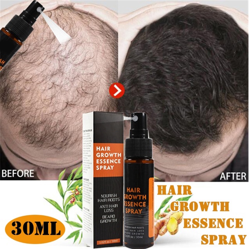 30ml Herbal Hair Growth Essence Spray | Shopee Singapore