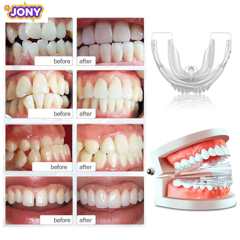 JONY New Orthodontic Braces Silicone Teeth Retainer Mouth Guard Health