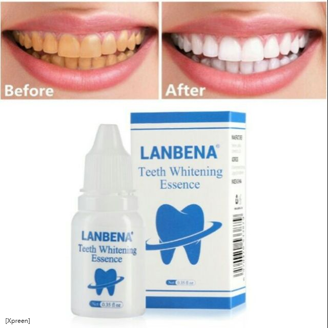 Ready Stock 😬 LANBENA Teeth Whitening Essence Shopee Singapore