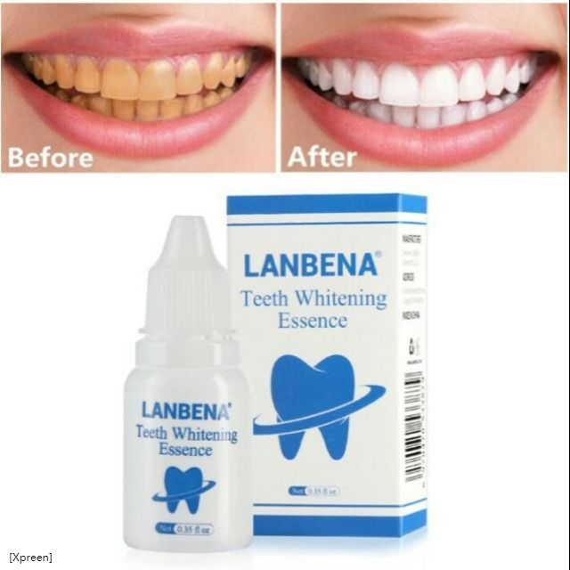 Ready Stock 😬 LANBENA Teeth Whitening Essence | Shopee Singapore