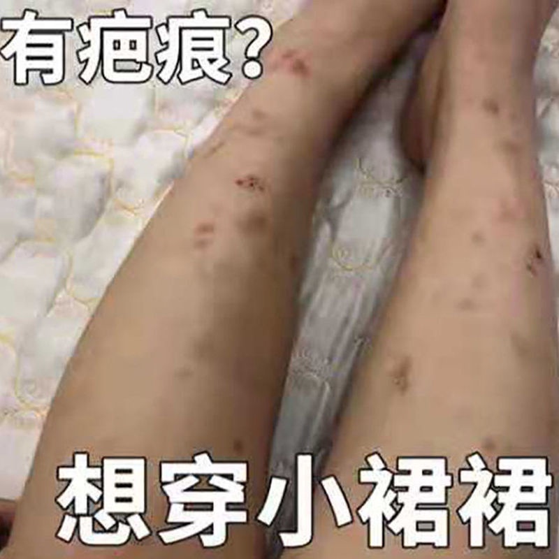 herborist-family-remove-mosquito-bites-scars-melanin-precipitation