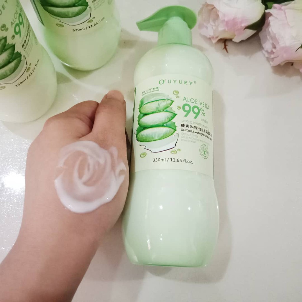 aloe vera lotion
