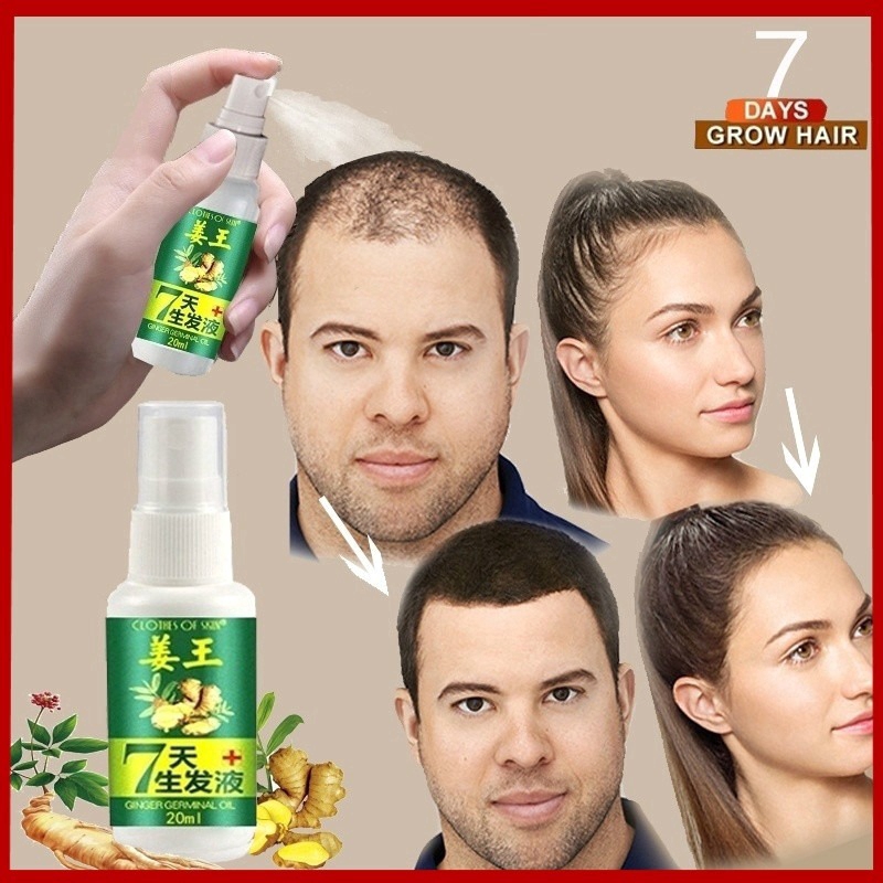 Ready Stock!30ml hair loss treatment ginger hair essence spray male and  female hair care lotion | Shopee Singapore