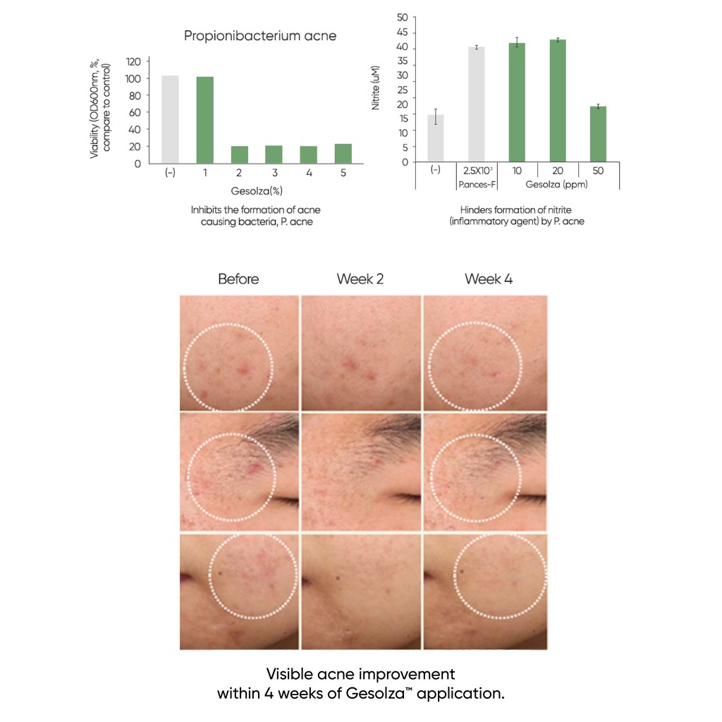 micro needle spot cream