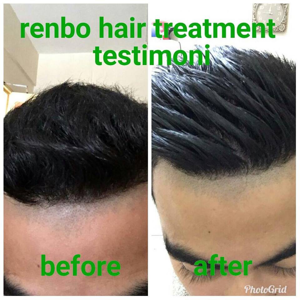 Hot Renbo Hair Straightener 3in1 Rebonding Pelurus Rambut Hair Straightening Lelaki Perempuan Kerinting Kering Shopee Singapore