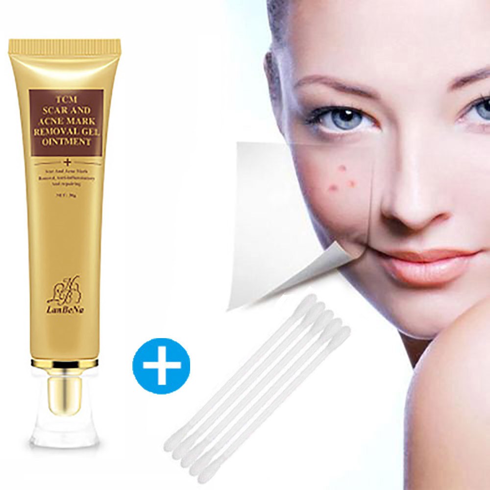 face acne scar removal cream