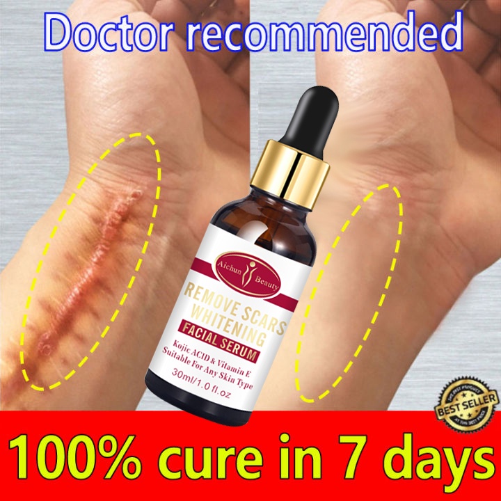Scar Removal Serum Scar Remover For Legs Acne Treatment Anti Acne Skin