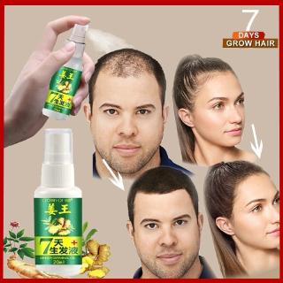 Image of Ready Stock！ 30ml Hair Loss Treatment Ginger Hair Growth Serum Hair Care for Men and Women