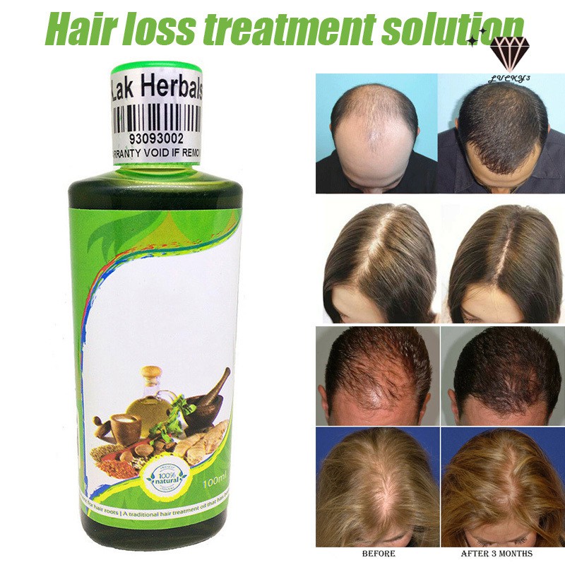 Hair Loss Treatment Regrow Liquid Care Protect from Dandruff for Women Men  | Shopee Singapore