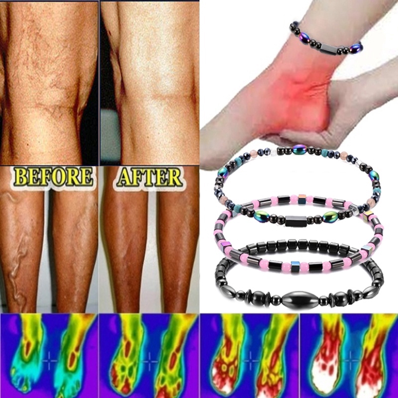 Magnetic Foot Bracelet  Improve Blood  Circulation Foot 