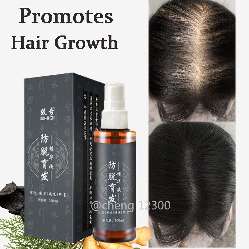Hair Tonic Serum Fast Hair Growth Serum Hair Tonic For Men &Women Hair  Growth Anti Hair Fall Hair Loss Serum 100ml | Shopee Singapore