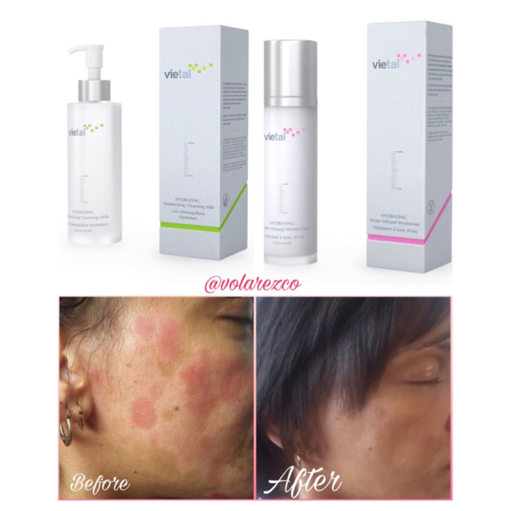 skincare to lighten dark spots