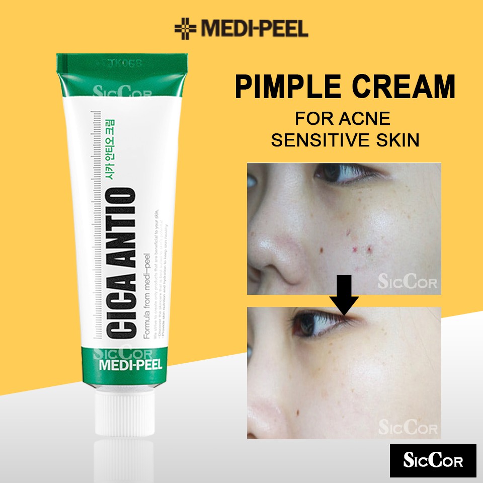 sensitive skin pimple cream