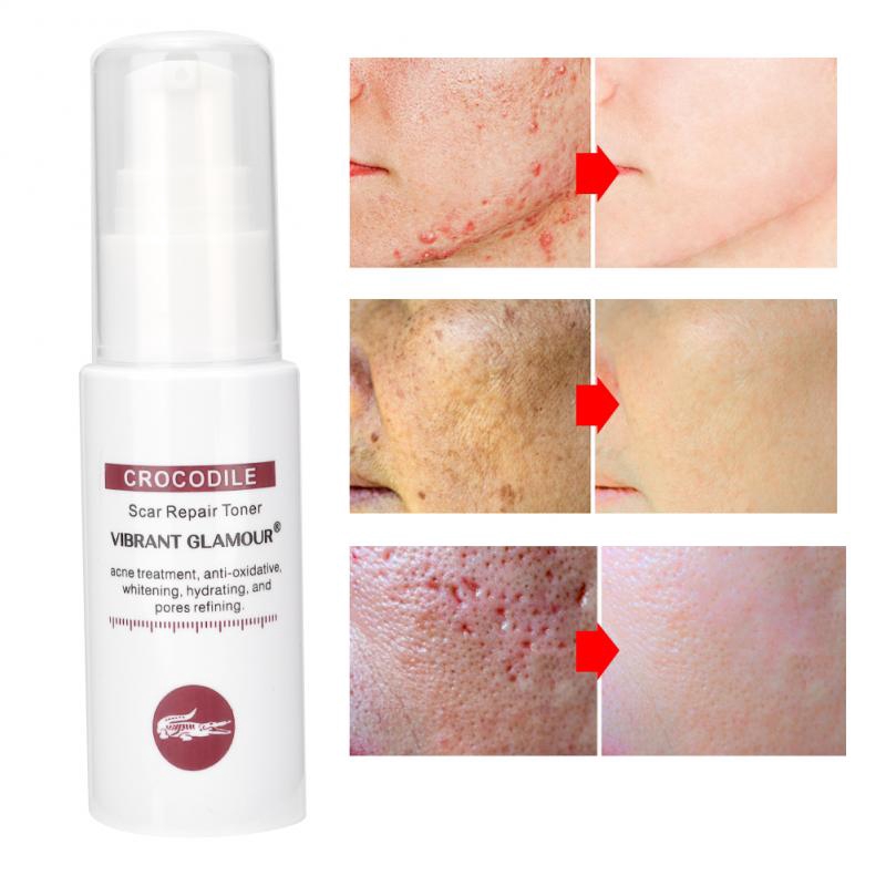 crocodile face toner