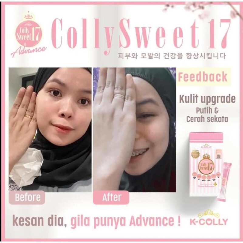 K Colly Advance Asha Box Shopee Singapore
