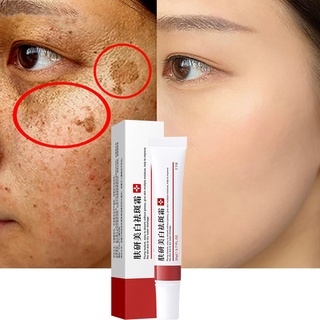 Effective Freckle Cream Remove Dark Spots Witening Cream Fade Acne Scars Melasma Anti-Aging Skin Lightening 20g