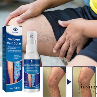 【💛JY】30ml Varicose Vein Treatment Spray Relief Phlebitis Angiitis Nerve Pain Massage Effective Feet Treatment Ointment Earthworm Leg Treatment Leg Swelling Pain Relief Gel