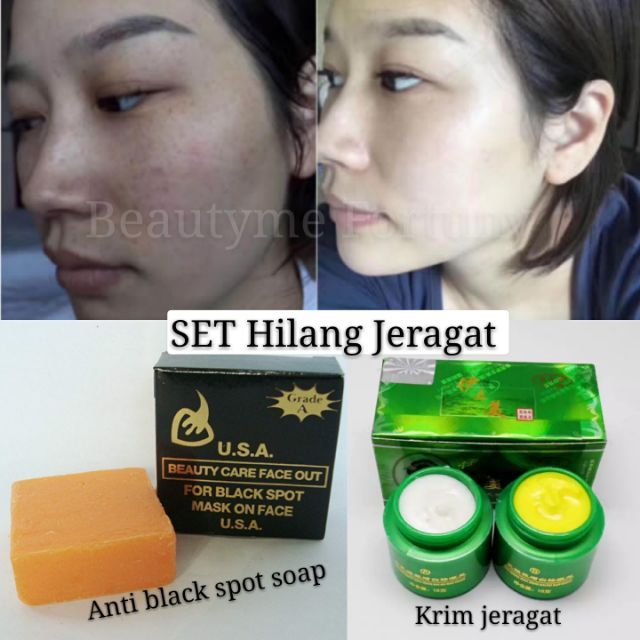 anti whitening cream