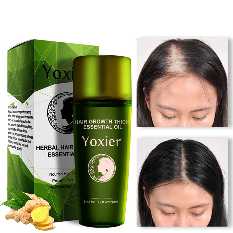 Yoxier Hair Growth Thicken Essential Oil Nourishing Hair Follicles Anti Hair Loss Hair Scalp Hair Regrowth Oil Shopee Singapore