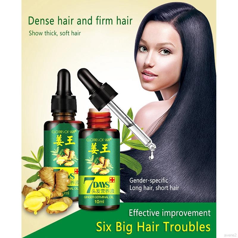 Hair Loss Treatment Ginger Hair Growth Serum For Thicker Healthier Hair Hair  Care For Men And Women | Shopee Singapore