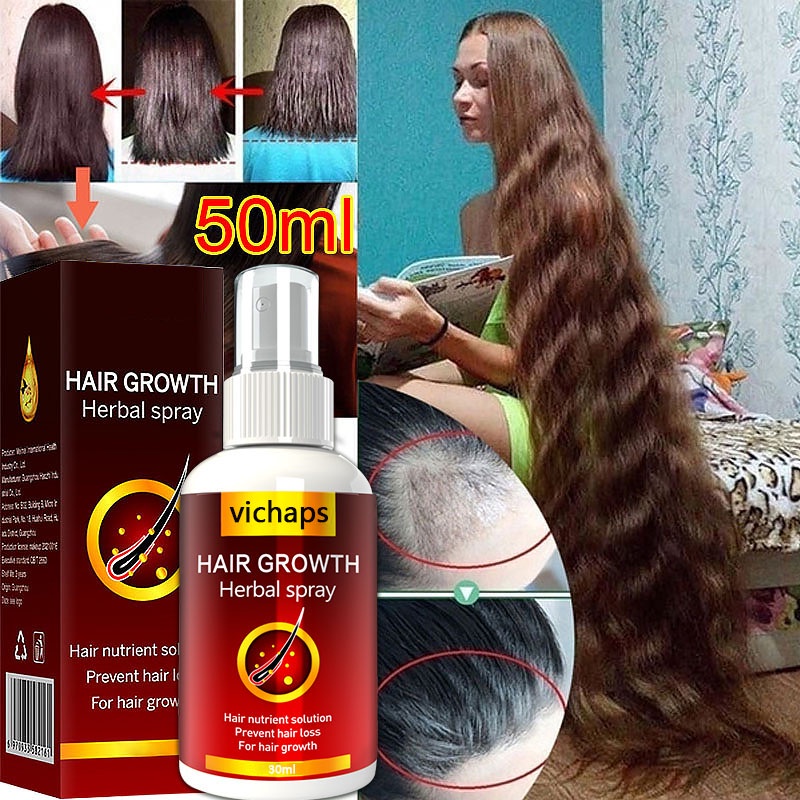 Hair Growth Serum Spray Fast Hair Growth Liquid Treatment Scalp Hair  Follicle Anti Hair Loss Natural Beauty Health Hair Care | Shopee Singapore