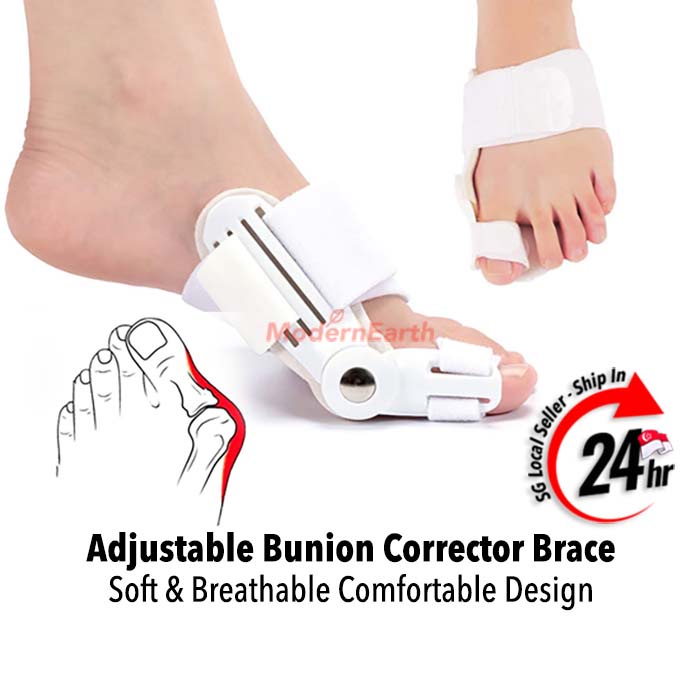 [SG Stock] Bunion Corrector - Orthopaedic Bunion Corrector - Bunion ...