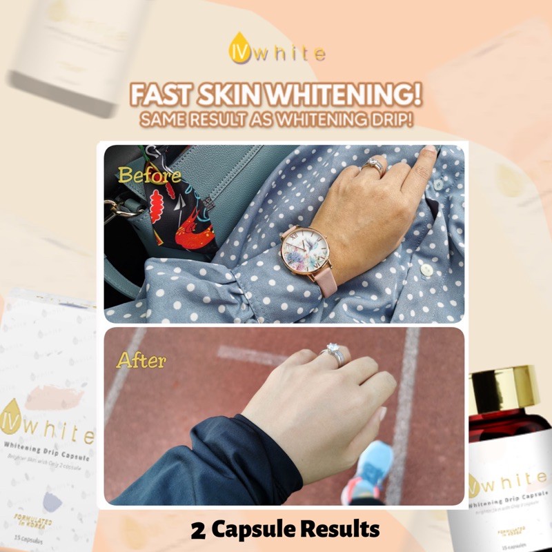 Ivwhite Korea Whitening Drip Capsule Supplement Highly Effective Glowing Skin Booster Shopee Singapore