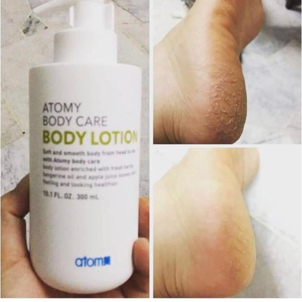 atomy lotion