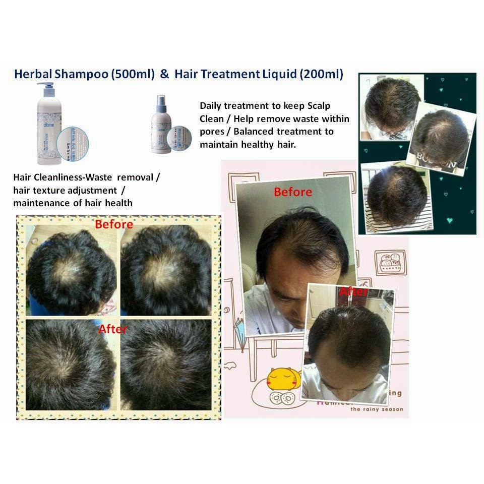 Herbal Hair Loss Shampoo+Hair Growth Tonic From Korea | Shopee Singapore