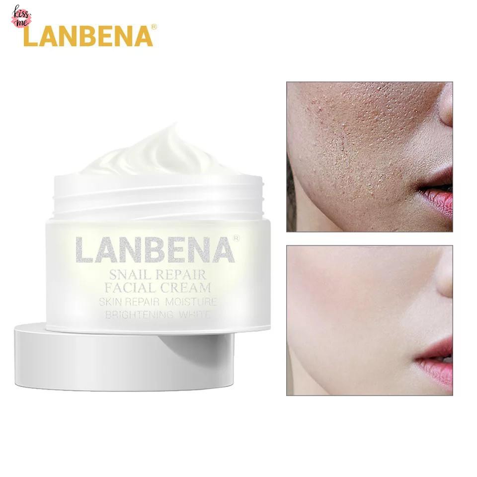 anti aging acne moisturizer
