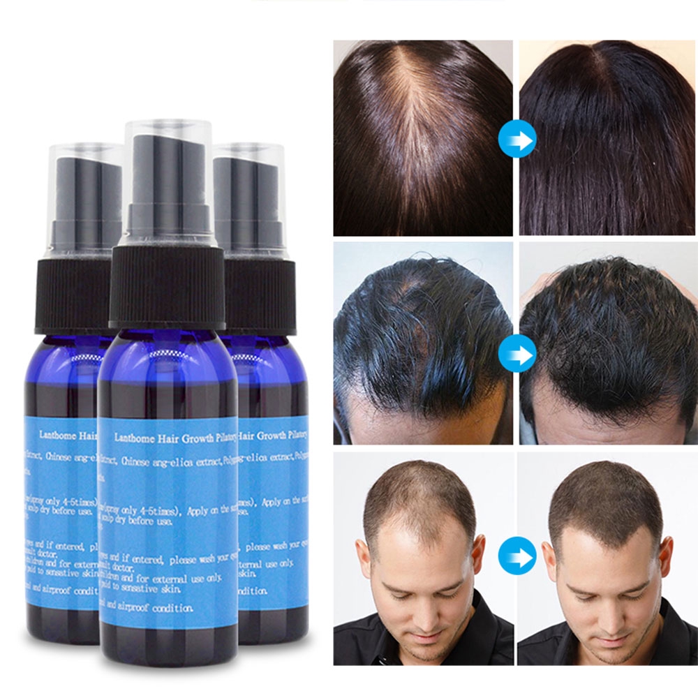 Hair Growth Essential Oil Spray Fast Grow Hair Root Nourishment