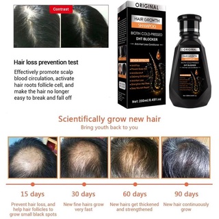 PEIMEI Hair Growth Essence Hair Shampoo Anti-Hair Loss Preventing Hair Loss Liquid Damage Hair Repair dht blocker