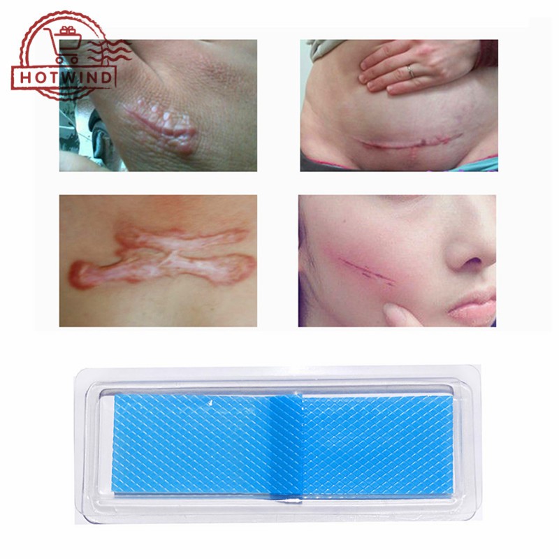 silicone gel patches for scars