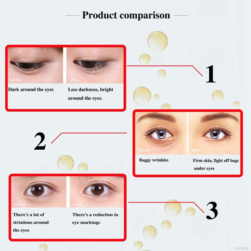 eye wrinkle repair