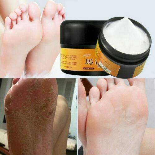 best foot cream for dryness