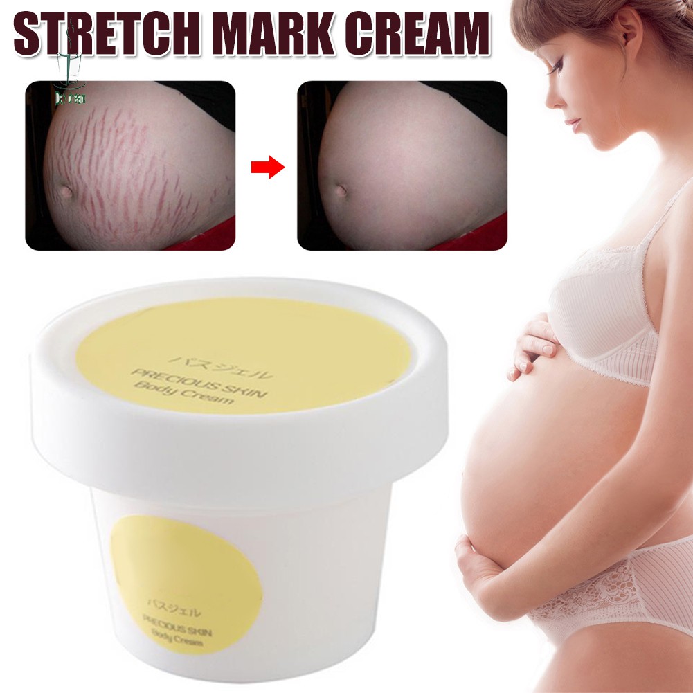 best scar cream for stretch marks