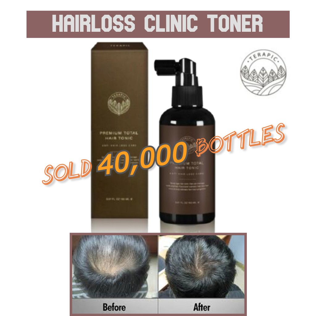 Terapic] Premium Total Hair Tonic/Hair Loss/Hair Care/Dandruff Hair Regrowth  | Shopee Singapore