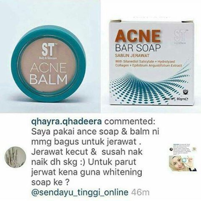 ni acne soap