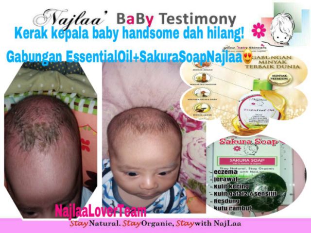 Najlaa Nutrien Oil Essential Oil Najlaa Smooth Baby Adult Hair Elak Hair Autumn Beautiful Skin Shopee Singapore