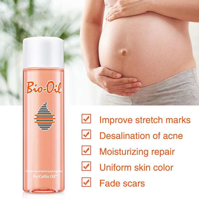 body stretch marks removal cream