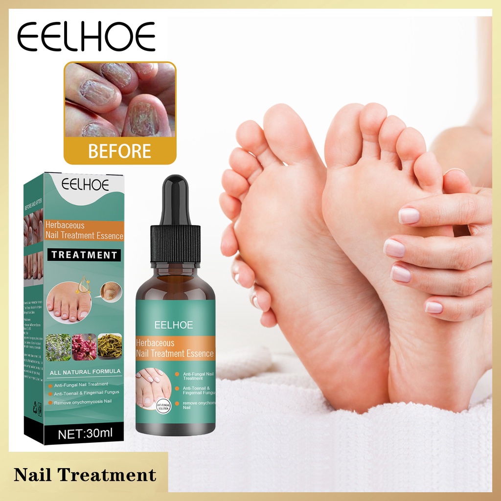 EELHOE Nail Repair Essence Serum Fungal Nail Treatment Remove ...