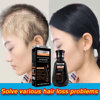 ⚡Ginger Hair Growth Shampoo⚡Anti-Hair Loss▲Promotes Hair Growth▲Repair Damaged Hair▲Nourish Scalp ▲ DHT Blocker