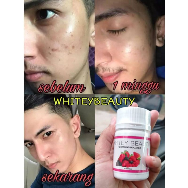 White Pill 1 Agency Whitening Booster Brightening Skin 30 Caps Shopee Singapore
