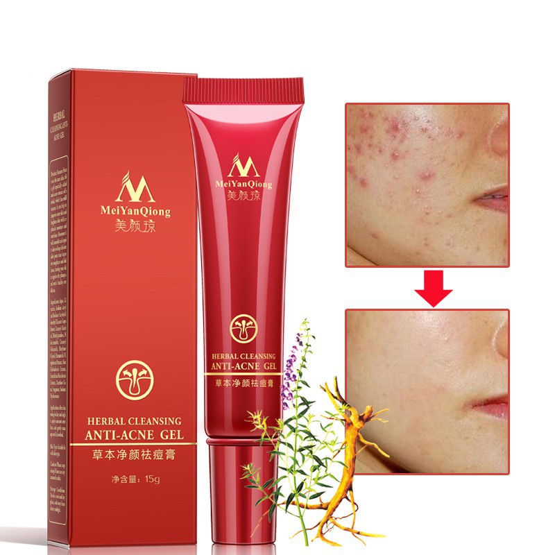 red acne cream