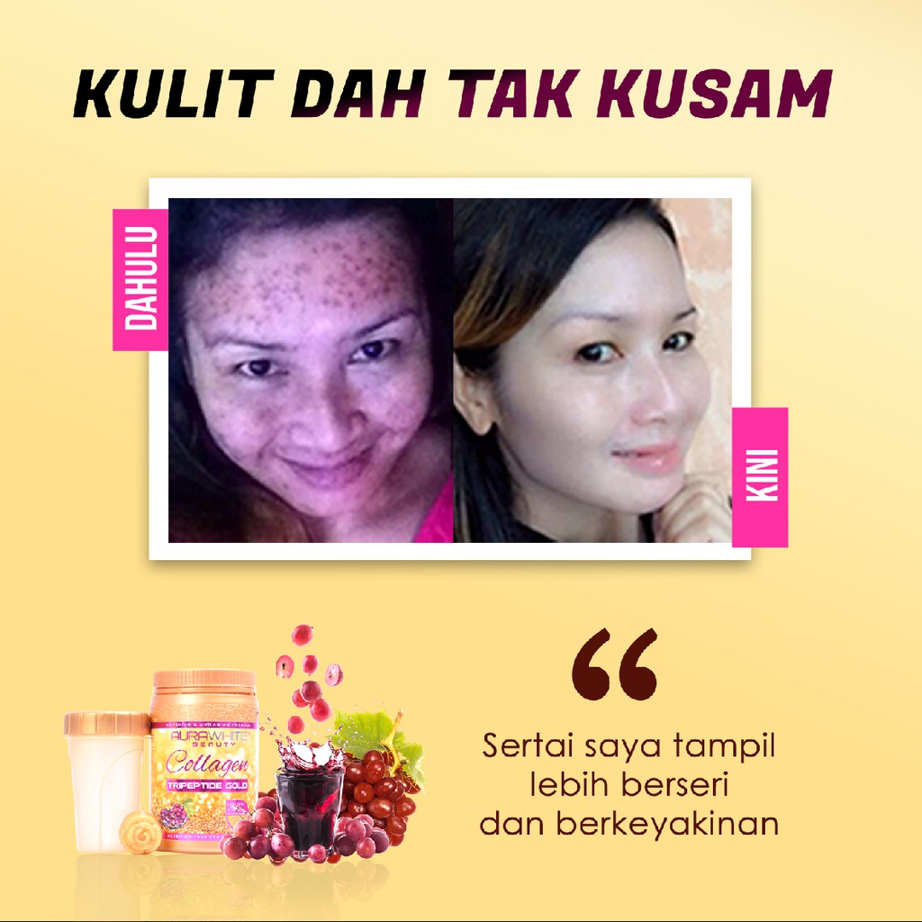 Shop Malaysia Aurawhite Collagen Tripeptide Gold Shopee Singapore