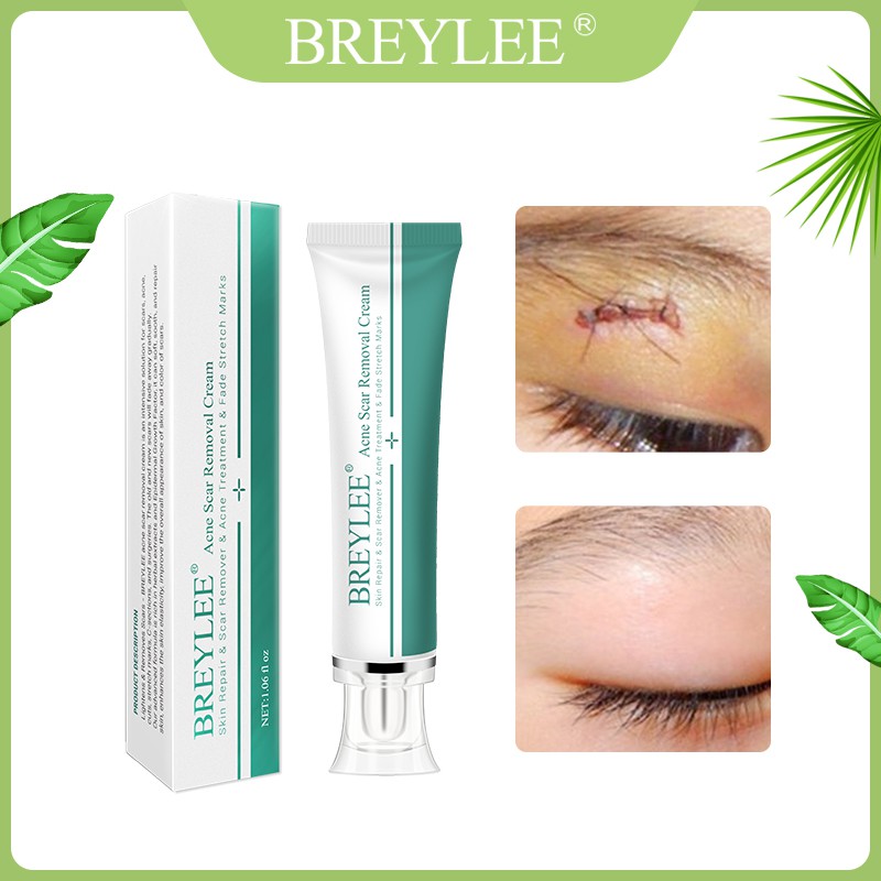 breylee scar removal cream