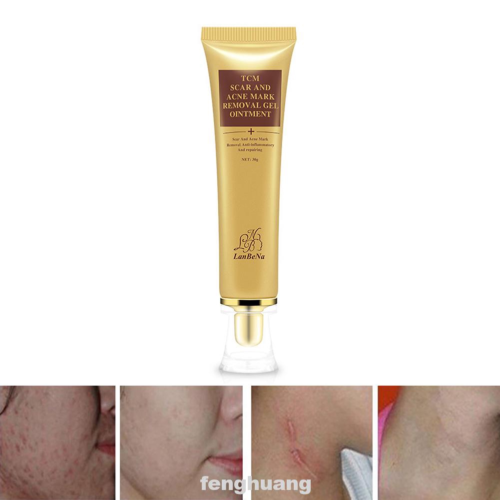 burning spot removal cream