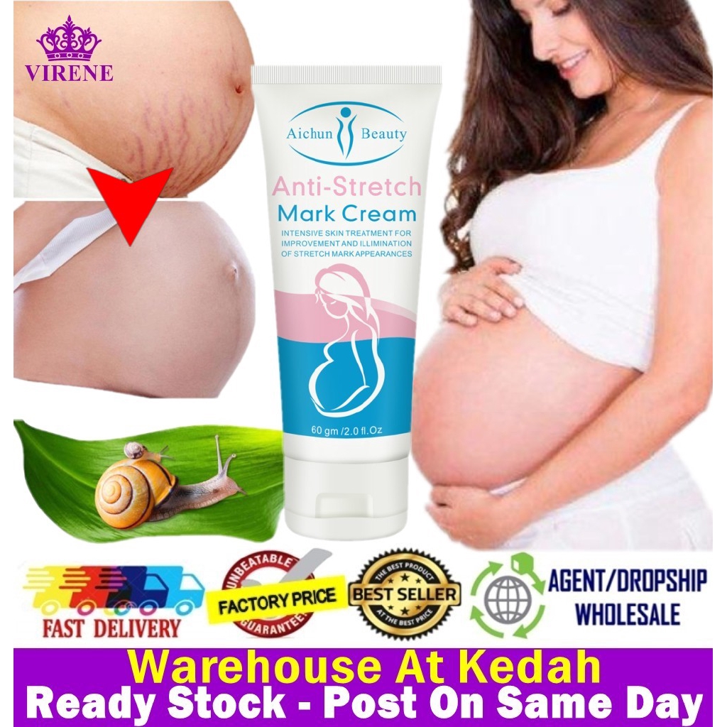 stretch marks cream before delivery