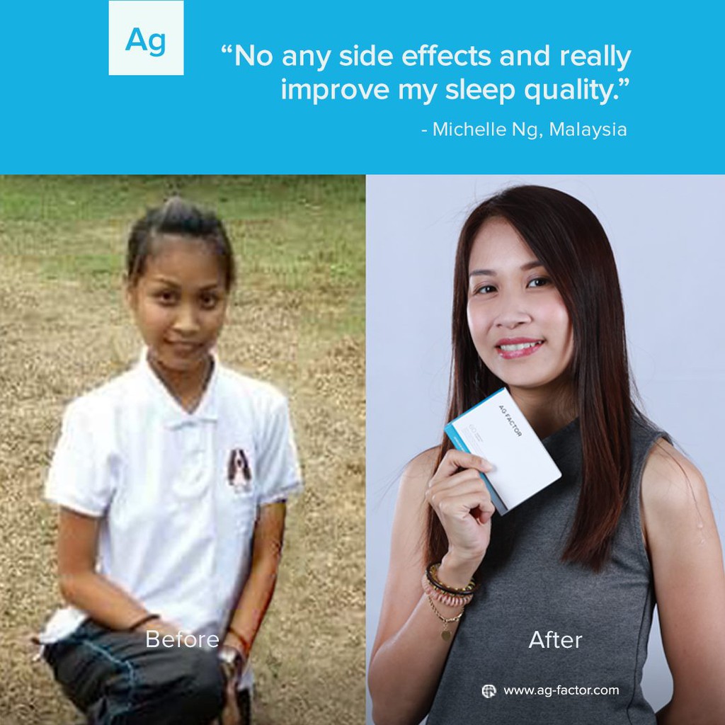 Ag Factor Anti Aging Skin Brightening Natural Beauty Supplement Shopee Singapore