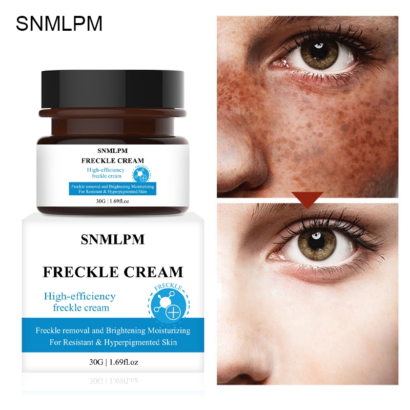 cream remove dark spots on face